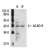 ACAD-8 (E-17): sc-66708. Western blot analysis of ACAD-8 expression in non-transfected: sc-110760 (A) and human ACAD-8 transfected: sc-110621 (B) 293 whole cell lysates.