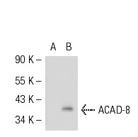 ACAD-8 (E-17): sc-66708. Western blot analysis of ACAD-8 expression in non-transfected: sc-117752 (A) and mouse ACAD-8 transfected: sc-118182 (B) 293T whole cell lysates.