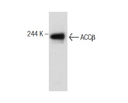 ACCβ (C-18): sc-26821. Western blot analysis of ACCβ expression in human liver tissue extract.