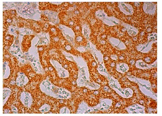 ACCβ (F-16): sc-26820. Immunoperoxidase staining of formalin fixed, paraffin-embedded human liver tissue showing cytoplasmic staining of hepatocytes.