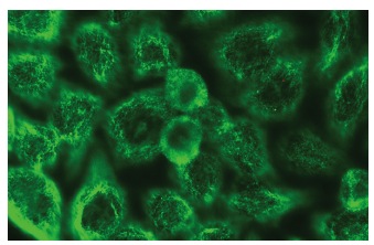 EP4 (C-4): sc-55596. Immunofluorescence staining of methanol-fixed HeLa cells showing membrane localization.
