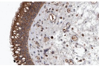 ADAM23 (H-65): sc-50482. Immunoperoxidase staining of formalin fixed, paraffin-embedded human nasopharynx showing cytoplasmic staining of respiratory epithelial cells at high magnification. Kindly provided by The Swedish Human Protein Atlas (HPA) program.