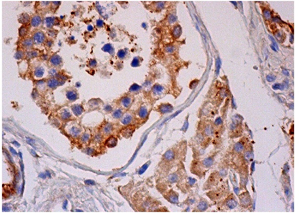 ADAM32 (A-5): sc-376738. Immunoperoxidase staining of formalin fixed, paraffin-embedded human testis tissue showing cytoplasmic and membrane staining of cells in seminiferous ducts and cytoplasmic staining of Leydig cells.