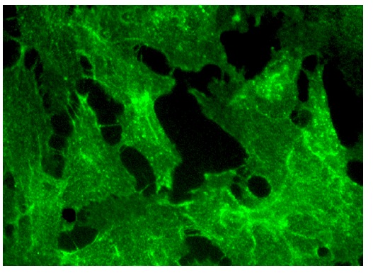 ADAM32 (A-5): sc-376738. Immunofluorescence staining of formalin-fixed HepG2 cells showing membrane localization.