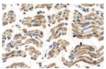 ALDH4A1 (F-25): sc-130948. Immunoperoxidase staining of formalin-fixed, paraffin-embedded human muscle tissue showing cytoplasmic localization.
