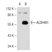 ALDH4A1 (F-25): sc-130948. Western blot analysis of ALDH4A1 expression in non-transfected: sc-117752 (A) and mouse ALDH4A1 transfected: sc-124945 (B) 293T whole cell lysates.