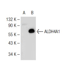 ALDH4A1 (F-25): sc-130948. Western blot analysis of ALDH4A1 expression in non-transfected: sc-117752 (A) and mouse ALDH4A1 transfected: sc-124945 (B) 293T whole cell lysates.