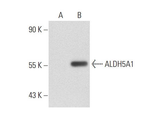 ALDH5A1 (B-24): sc-130684. Western blot analysis of ALDH5A1 expression in non-transfected: sc-117752 (A) and human ALDH5A1 transfected: sc-175083 (B) 293T whole cell lysates.