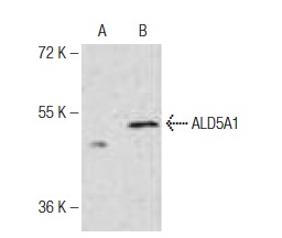 ALDH5A1 (B-24): sc-130684. Western blot analysis of ALDH5A1 expression in non-transfected (A) and human ALDH5A1 transfected (B) 293 whole cell lysates.