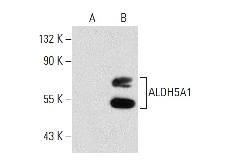 ALDH5A1 (B-24): sc-130684. Western blot analysis of ALDH5A1 expression in non-transfected: sc-117752 (A) and human ALDH5A1 transfected: sc-175079 (B) 293T whole cell lysates.