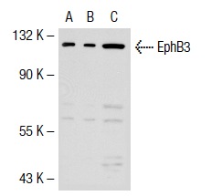 EphB1 (Q-20): sc-926. Western blot analysis of EphB3 expression in non-transfected 293T: sc-117752 (A), human EphB3 transfected 293T: sc-116104 (B) and HeLa (C) whole cell lysates.