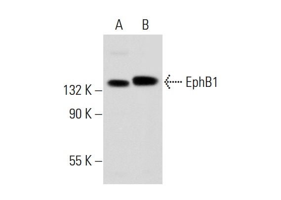 EphB1 (Q-20): sc-926. Western blot analysis of EphB1 expression in IMR-32 (A) and MDA-MB-468 (B) whole cell lysates.