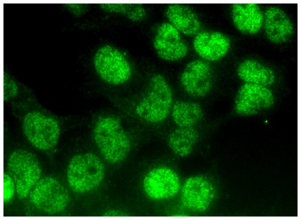 AOS-1 (H-7): sc-271592. Immunofluorescence staining of formalin-fixed HepG2 cells showing nuclear localization.