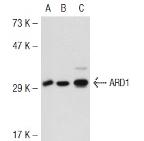 ARD1 (E-16): sc-33256. Western blot analysis of ARD1 expression in non-transfected 293T: sc-117752 (A), mouse ARD1 transfected 293T: sc-118513 (B) and HeLa (C) whole cell lysates.
