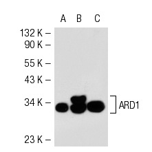 ARD1 (E-16): sc-33256. Western blot analysis of ARD1 expression in non-transfected 293T: sc-117752 (A), human ARD1 transfected 293T: sc-128004 (B) and HeLa (C) whole cell lysates.
