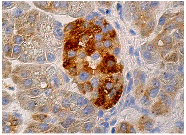 Asparagine synthetase (G-10): sc-365809. Immunoper-oxidase staining of formalin fixed, paraffin-embedded human pancreas tissue showing cytoplasmic staining of Islet of Langerhans and glandular cells.