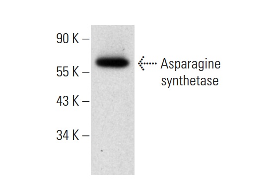 Asparagine synthetase (G-10): sc-365809. Western blot analysis of Asparagine synthetase expression in Jurkat whole cell lysate.