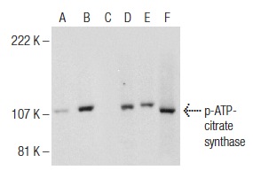 Western blot analysis of ATP-citrate synthase phosphorylation in untreated (A,D), calyculin A treated (B,E) and calyculin A and lambda protein phosphatase (sc-200312A) treated (C,F) Jurkat whole cell lysates. Antibodies tested include p-ATP-citrate synthase (A-12): sc-374647 (A,B,C) and ATP-citrate synthase (C-20): sc-30538 (D,E,F).