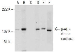 Western blot analysis of ATP-citrate synthase phosphorylation in untreated (A,D), calyculin A treated (B,E) and calyculin A and lambda protein phosphatase (sc-200312A) treated (C,F) Jurkat whole cell lysates. Antibodies tested include p-ATP-citrate synthase (Ser 455): sc-33397 (A,B,C) and ATP-citrate synthase (C-20): sc-30538 (D,E,F).
