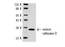 cathepsin D (G-19): sc-6494. Western blot analysis of cathepsin D expression in ZR-75-1 whole cell lysate revealing presence of 31 kDa processed form (lower form).