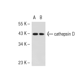 cathepsin D (G-19): sc-6494. Western blot analysis of cathepsin D expression in non-transfected: sc-117752 (A) and mouse cathepsin D transfected: sc-126582 (B) 293T whole cell lysates.