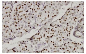 CMAS (14W): sc-100486. Immunoperoxidase staining of formalin-fixed, paraffin-embedded human salivary gland tissue showing nuclear localization.
