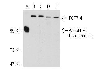 FGFR-4 (A-10): sc-136988. Western blot analysis of truncated human recombinant FGFR-4 fusion protein (A) and HeLa (B), MCF7 (C), CSMLO (D) and KNRK (E) whole cell lystates.
