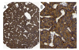 cPLA<sub>2</sub> (N-216) sc-438. Immunoperoxidase staining of formalin fixed, paraffin-embedded human parathyroid gland tissue showing cytoplasmic staining of glandular cells at low (A) and high (B) magnification. Kindly provided by The Swedish Human Protein Atlas (HPA) program.