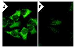 cPLA<sub>2</sub> siRNA (h): sc-29280. Immunofluorescence staining of methanol-fixed, control HeLa (A) and cPLA<sub>2</sub> siRNA silenced HeLa (B) cells showing diminished cytoplasmic staining in the siRNA silenced cells. Cells probed with cPLA<sub>2</sub> (C-20): sc-1724.