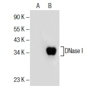 DNase l (B-4): sc-376207. Western blot analysis of DNase I expression in non-transfected: sc-117752 (A) and mouse DNase I transfected: sc-119807 (B) 293T whole cell lysates.