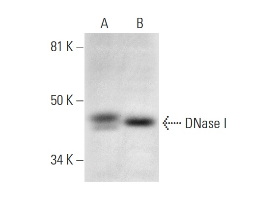 DNase I (B-4): sc-376207. Western blot analysis of DNase I expression in MCF7 (A) and HeLa (B) whole cell lysates.