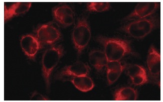 Fatty Acid Synthase (H-300): sc-20140. Immunofluorescence staining of methanol-fixed HeLa cells showing cytoplasmic localization.