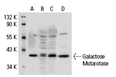 Galactose Mutarotase (G-17): sc-51291. Western blot analysis of Galactose Mutarotase expression in non-transfected 293: sc-110760 (A), human Galactose Mutarotase transfected 293: sc-112214 (B) and Hep G2 (C) whole cell lysates.