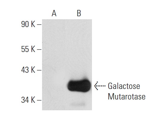 Galactose Mutarotase (C-4): sc-166471. Western blot analysis of Galactose Mutarotase expression in non-transfected: sc-117752 (A) and mouse Galactose Mutarotase transfected: sc-120388 (B) 293T whole cell lysates.