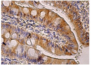 Galactose Mutarotase (C-4): sc-166471. Immunoperox-idase staining of formalin fixed, paraffin-embedded human small intestine tissue showing nuclear and cytoplasmic staining of glandular cells.