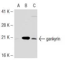gankyrin (H-231): sc-8991. Western blot analysis of gankyrin expression in non-transfected 293T: sc-117752 (A), mouse gankyrin transfected 293T: sc-120400 (B) and HeLa (C) whole cell lysates.