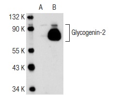Glycogenin-2 (3L10): sc-134346. Western blot analysis of Glycogenin-2 expression in non-transfected: sc-117752 (A) and human Glycogenin-2 transfected: sc-113712 (B) 293T whole cell lysates.