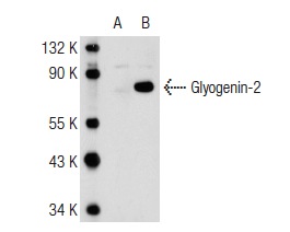 Glycogenin-2 (3L10): sc-134346. Western blot analysis of Glycogenin-2 expression in non-transfected: sc-117752 (A) and human Glycogenin-2 transfected: sc-176507 (B) 293T whole cell lysates.