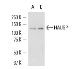 HAUSP (H-200): sc-30164. Western blot analysis of HAUSP expression in HeLa (A) and A-431 (B) whole cell lysates.