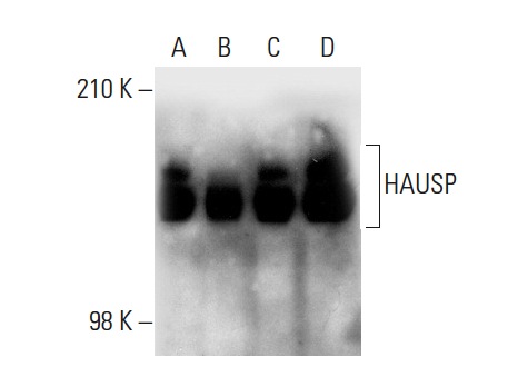 HAUSP (H-200): sc-30164. Western blot analysis of HAUSP expression in HeLa (A), A-431 (B), K-562 (C) and Jurkat (D) whole cell lysates.