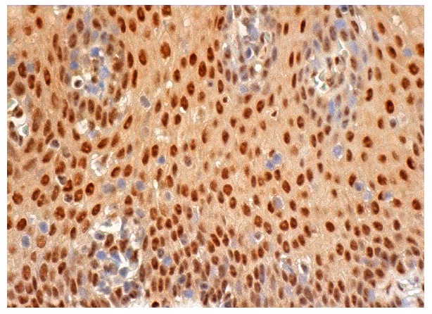 HAUSP (H-200): sc-30164. Immunoperoxidase staining of formalin fixed, paraffin-embedded human esophagus tissue showing nuclear and cytoplasmic staining of squamous epithelial cells.