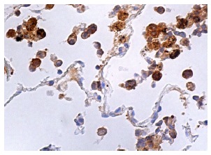Heme Oxygenase 1 (D-8): sc-136961. Immunoperoxidase staining of formalin fixed, paraffin-embedded human lung tissue showing cytoplasmic staining of macrophages.