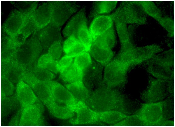 Heme Oxygenase 1 (D-8): sc-136961. Immunofluores-cence staining of formalin-fixed HepG2 cells showing cytoplasmic localization.