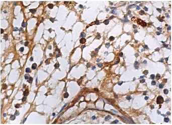 Heme Oxygenase 1 (A-3): sc-136960. Immunoperoxidase staining of formalin fixed, paraffin-embedded human bone marrow tissue showing cytoplasmic staining of hematopoietic cells.