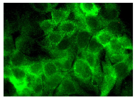 Heme Oxygenase 1 (A-3): sc-136960. Immunofluorescence staining of formalin-fixed HepG2 cells showing cytoplasmic localization.
