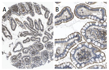 Hepatic Lipase (XHL1-1C): sc-21741. Immunoperoxidase staining of formalin fixed, paraffin-embedded human small intestine tissue showing microvilli staining of glandular cells at low (A) and high (B) magnification. Kindly provided by The Swedish Human Protein Atlas (HPA) program.