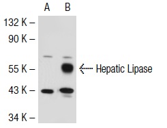 Hepatic Lipase (XHL1-1C): sc-21741. Western blot analysis of Hepatic Lipase expression in non-transfected: sc-117752 (A) and human Hepatic Lipase transfected: sc-112686 (B) 293T whole cell lysates.