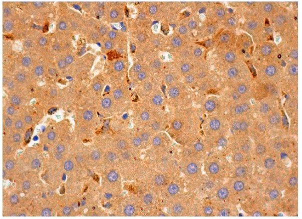 IVD (B-9): sc-271205. Immunoperoxidase staining of formalin fixed, paraffin-embedded human liver tissue showing cytoplasmic staining of hepatocytes.