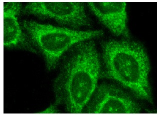 frizzled-4 (C-18): sc-66450. Immunofluorescence staining of methanol-fixed HeLa cells showing cytoplasmic localization.