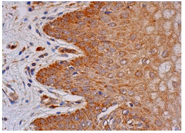 frizzled-4 (C-18): sc-66450. Immunoperoxidase staining of formalin fixed, paraffin-embedded human vagina tissue showing cytoplasmic staining of squamous epithelial cells.